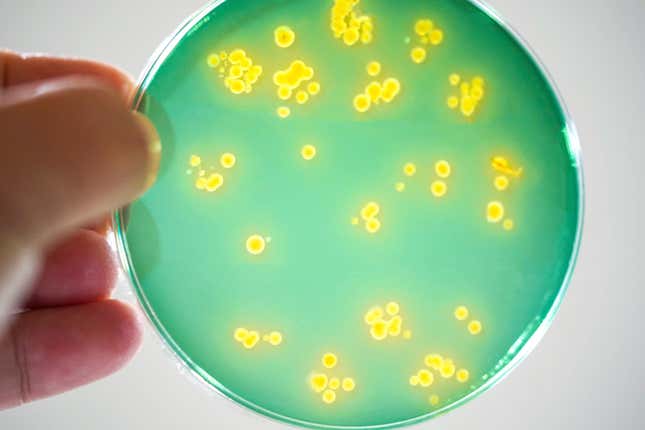 Vibrio bacteria being grown on a petri dish.