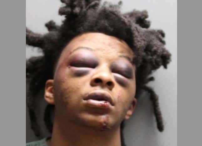 Image for article titled Jacksonville Sheriff Releases New Details Behind Brutal Beating