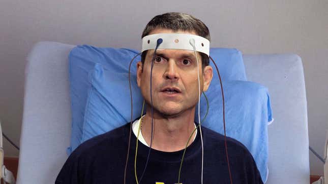 Image for article titled Jim Harbaugh Disappointed To Learn Electroshock Therapy Session Already Over