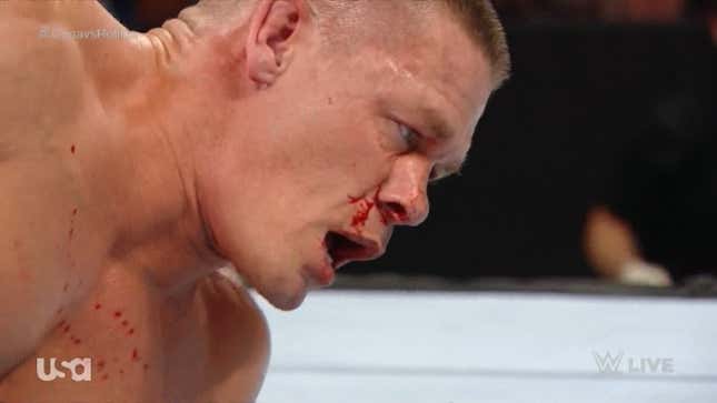Wrestling's Fake, But John Cena's Broken Nose Is All Too Real