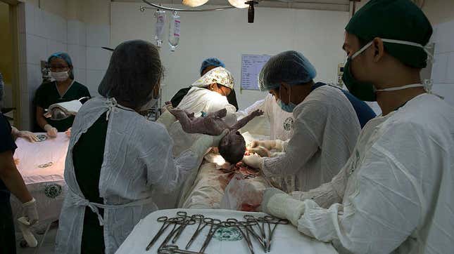 Image for article titled C-Section Stigma Is Contributing to Maternal Mortality