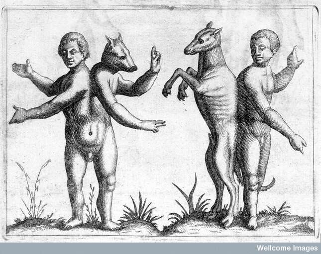 Image for article titled One Person, Two Sets of DNA: The Strange Case of the Human Chimera