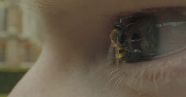 Whooooo wants to see Ed Sheeran get stung in the eye by a bee?