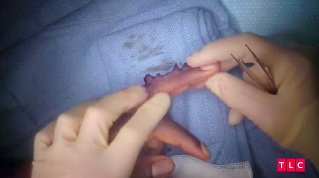 Image for article titled Dr. Pimple Popper Takes Us to Church