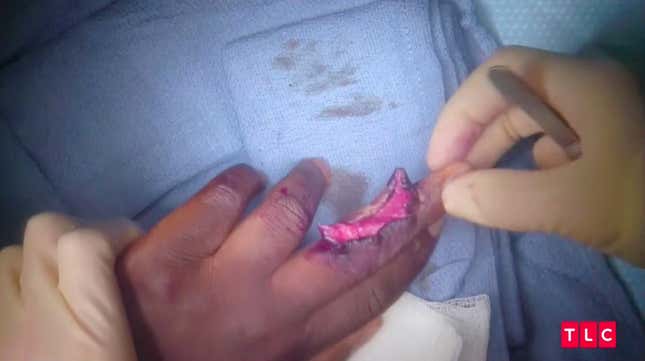 Image for article titled Dr. Pimple Popper Takes Us to Church
