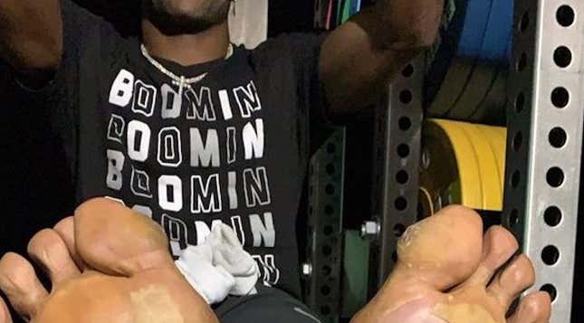 Antonio Brown's Feet Are A Nightmare