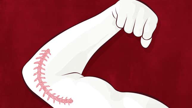 Image for article titled Inside The Room For Tommy John Surgery, Baseball&#39;s Most Important Cut