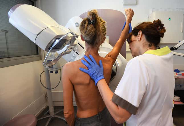 Image for article titled Cool, Medical Experts Still Can't Agree on When People Should Start Getting Mammograms