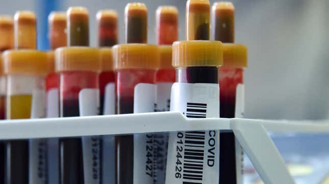 Blood samples about to be tested for covid-19 antibodies at a clinic in Moscow on May 15, 2020