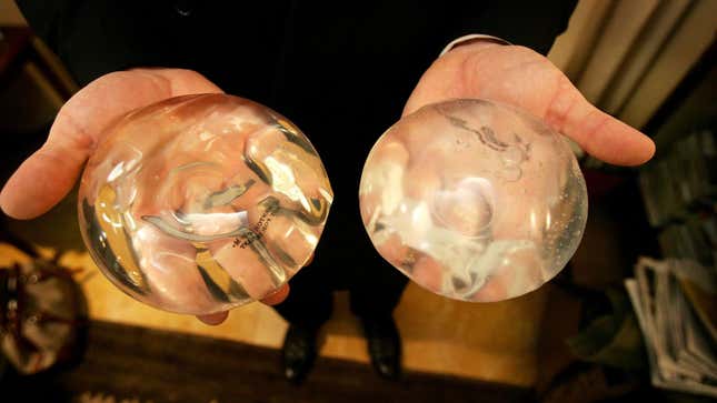 Image for article titled A Woman's Breast Implant Bounced Away a Bullet & Saved Her Life
