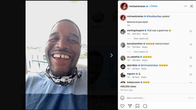 Image for article titled Michael Strahan's Tooth Gap Got Me Good!