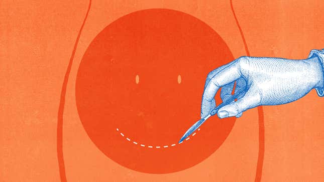 Image for article titled An Unnatural Birth: In Praise of the Caesarean Section