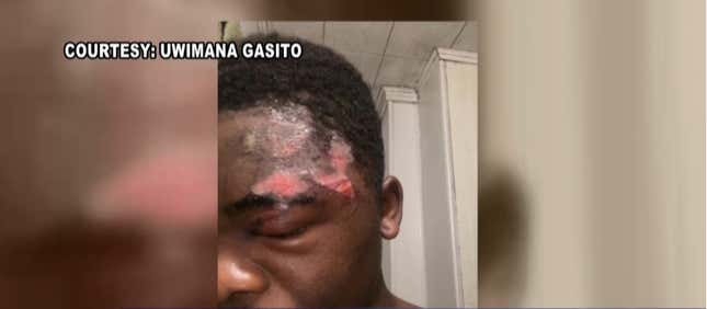 Image for article titled Victim of Alleged Police Brutality Incident Won’t Receive Justice, but He Won’t be Charged With Any Crimes Either