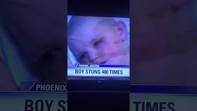 Boy Uses <i>Dragon Ball Z</i> To Survive Bee Attack <em></em>
