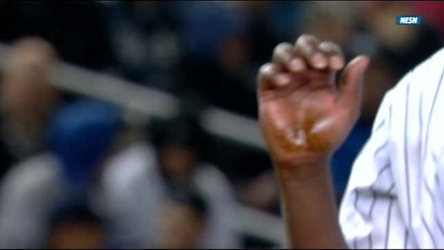 Michael Pineda's Not Being Discreet About The Pine Tar On His Hand