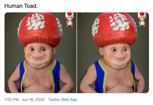 Image for article titled Human Toad Is Freaky And Terrifying