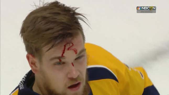 Nick Ritchie Tags Viktor Arvidsson With The Mark Of The Beast<em></em>