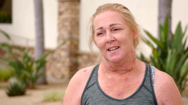 Image for article titled Dr. Pimple Popper Goes Head-to-Head With a Nipple... on Someone's Head