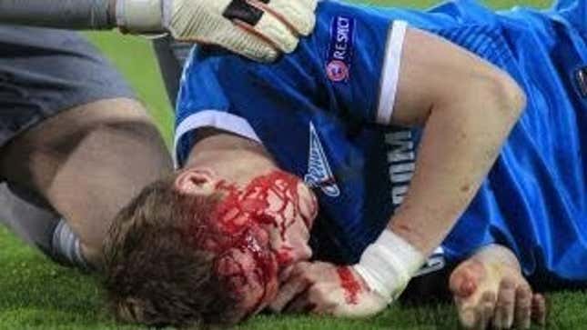 Zenit Player's Face Was A River Of Blood After Getting Kneed In Head