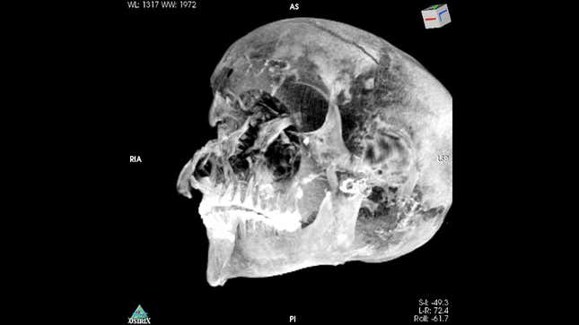 3D image showing the pharaoh’s badly damaged skull. 
