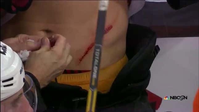 Brayden Schenn Takes A Skate To The Stomach, Returns To The Game