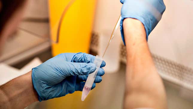 Image for article titled Woman Sues Fertility Doctor After Learning He Used His Own Sperm To Impregnate Her