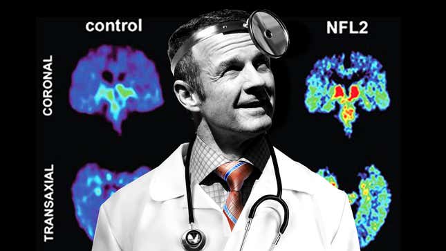 Image for article titled Merril Hoge Doesn't Want You To Use Your Brain