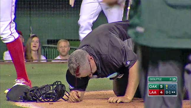Paul Emmel's Head Cracked Open By Bat
