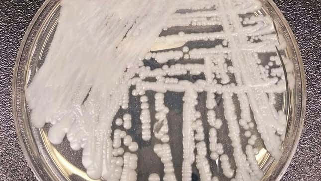 Image for article titled We Should All Probably Freak Out About This Deadly, Drug-Resistant Fungus